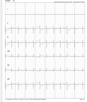 Can anyone read an ECG?