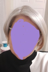 What can I do about my grey hair please?