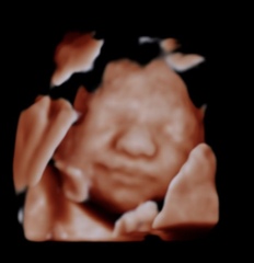 Due June 2022 Thread Nine