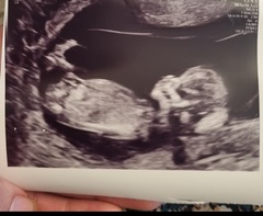 Gender Guess? Boy or girl??💕💙