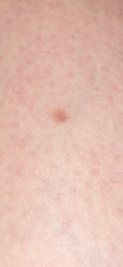 Any skin doctors around? What are these on my leg?