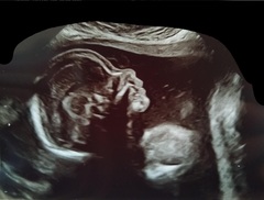 Any guesses on sex of the baby, we wish we'd asked now!