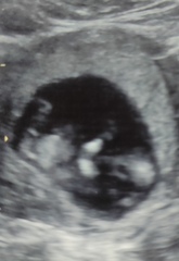 Posting scan pictures for another member. NUB guesses please