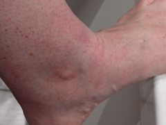 Help with skin condition