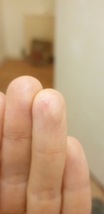 What is happening to my hands?!