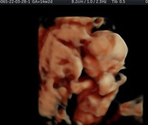 Due September 2022 (Thread 5!)