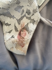 Blood at 34 weeks, TMI picture included