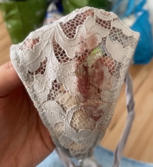Blood at 34 weeks, TMI picture included