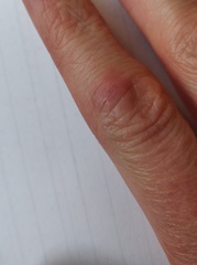 To ask you to help me work out what's going on with my fingers?