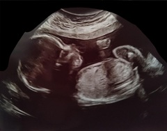 Any guesses on sex of the baby, we wish we'd asked now!