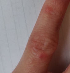 To ask you to help me work out what's going on with my fingers?
