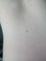 Help with skin condition