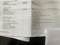What is wrong with my DD? Help!