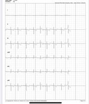 Can anyone read an ECG?