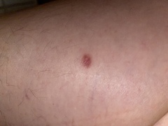 Any skin doctors around? What are these on my leg?