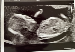 Gender guess