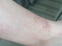 Help with skin condition