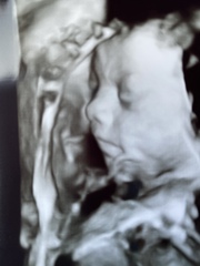 Hello ladies 40+ and Pregnant! 😀