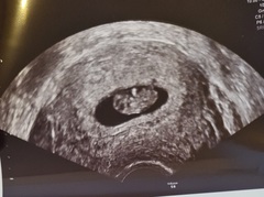 Early scan pics?