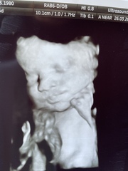 Hello ladies 40+ and Pregnant! 😀