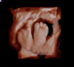 Due June 2022 Thread Nine