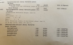 Please can someone help interpret results