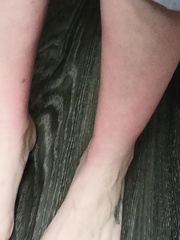 Help with skin condition