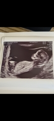 Gender Guess? Boy or girl??💕💙