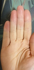 What is happening to my hands?!