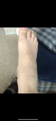 Would you go to a&e if you thought you had sprained your ankle?