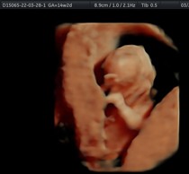 Due September 2022 (Thread 5!)