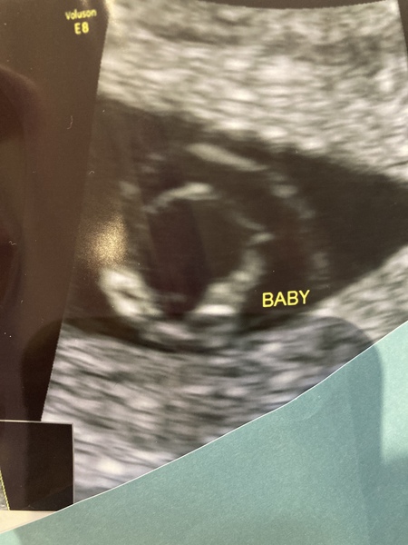 Should be 8 weeks, measuring 6 weeks with heartbeat