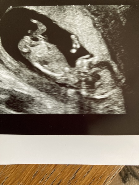 Boy or Girl?