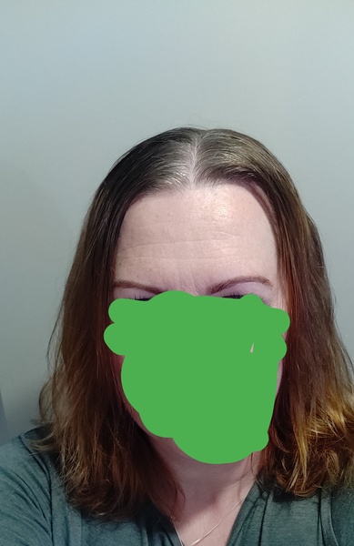 To fringe or not to fringe ...