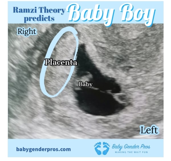 Due October 2022 thread #2 ... the first trimester continues!