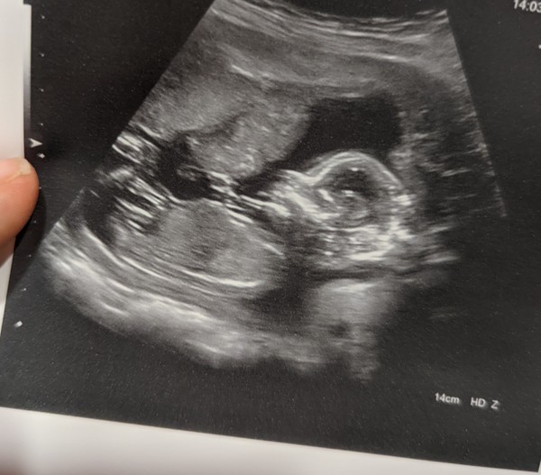 Gender guess