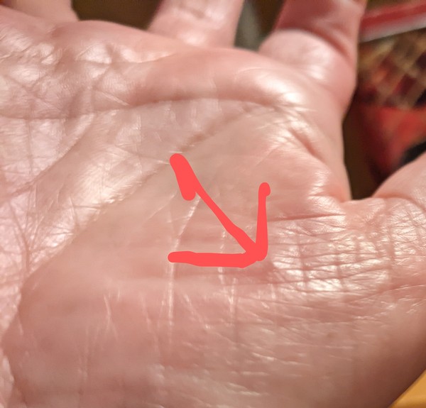 What is this spot?