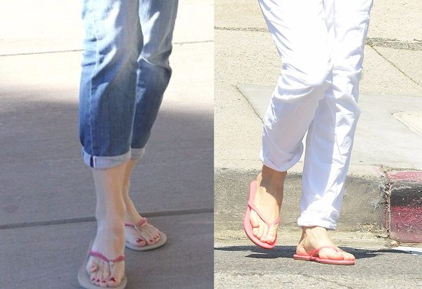 If you had deformed toes, would you be too embarrassed to get a pedicure?
