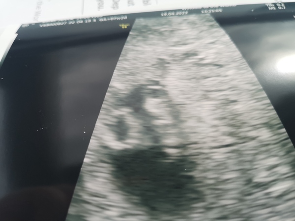 Due end November/early December