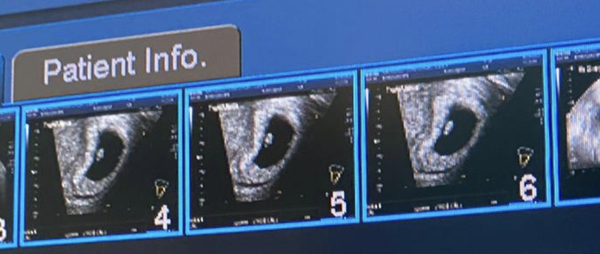 👶 Due November 2022 - part II 🎆