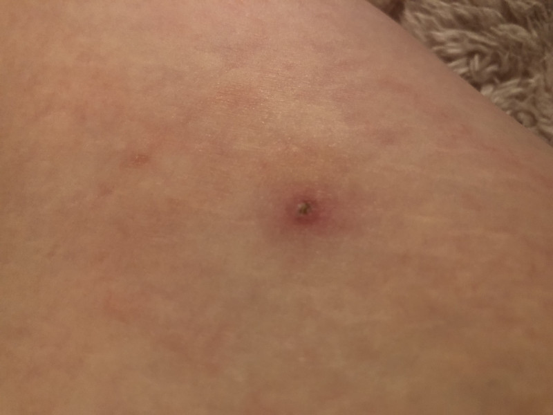 Does this look infected? 