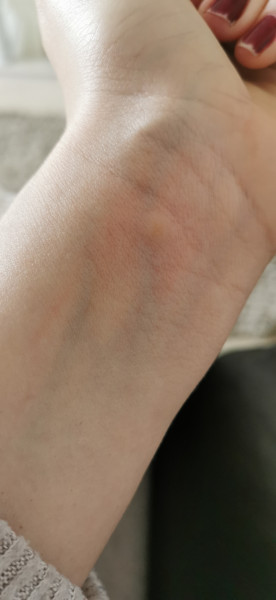 What's biting me 😭😭