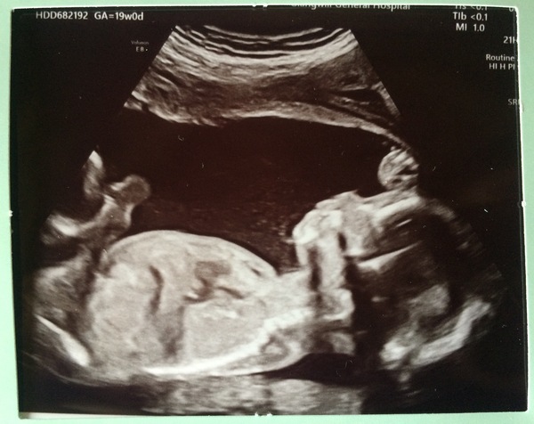 Due September 2022 (Thread 5!)