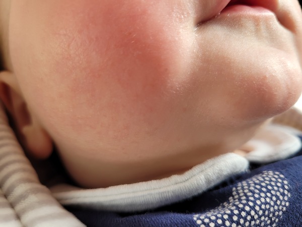 Baby skin - pic included