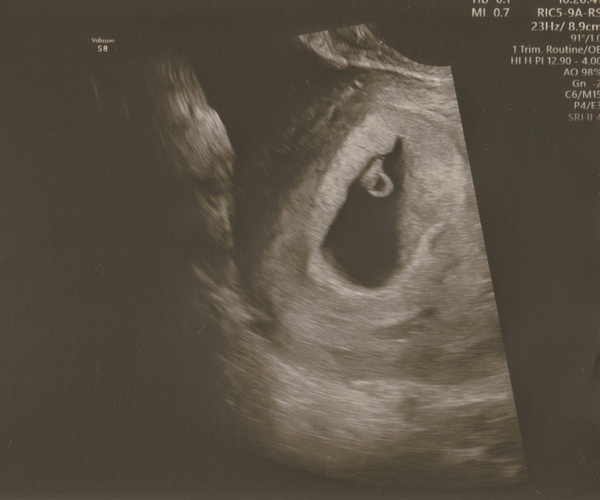 👶 Due November 2022 - part II 🎆