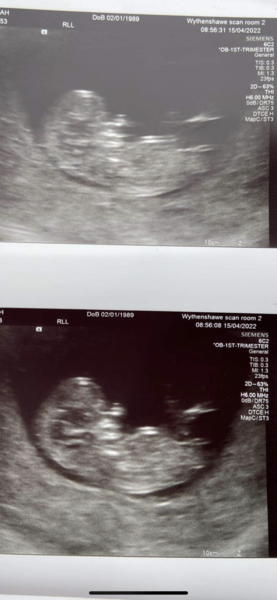 👶 Due November 2022 - part II 🎆