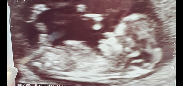 Due October 2022 thread #2 ... the first trimester continues!