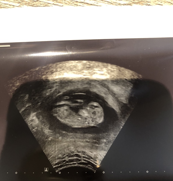 Any guesses on the gender of my baby?