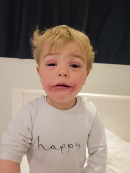 Help - minor injuries???