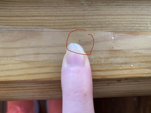 Do we have bed bugs?!